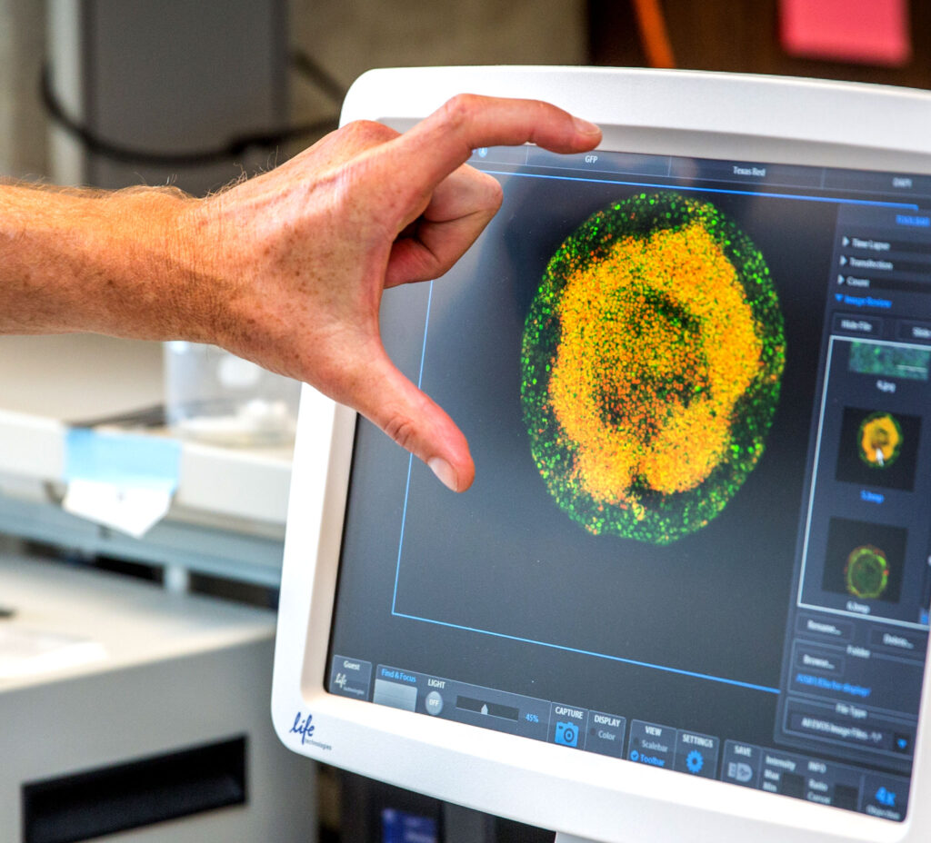 A computer monitor shows an oval-shaped scan. A man extends his thumb and forefinger to show the size of the image.